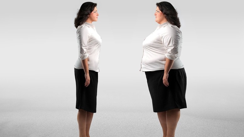 Dismorfismo corporeo