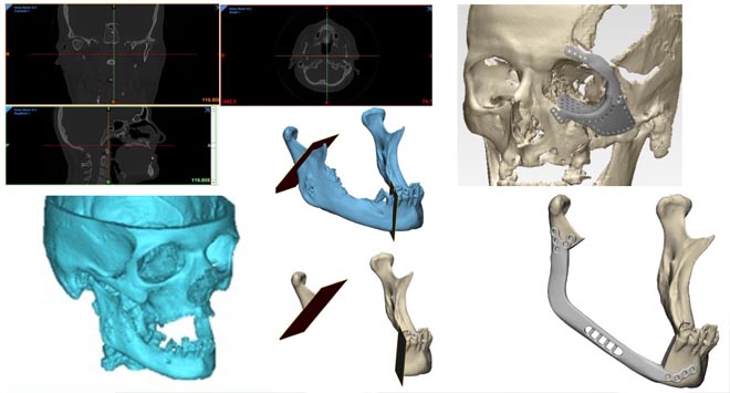 interventi maxillo facciali