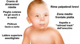 feto alcolica